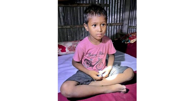 সৎবাবার হাতে শিশু নির্যাতন